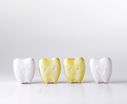 Discolored or stained teeth